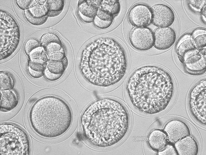 Panama_2010_48_urchin_embryos2_2009