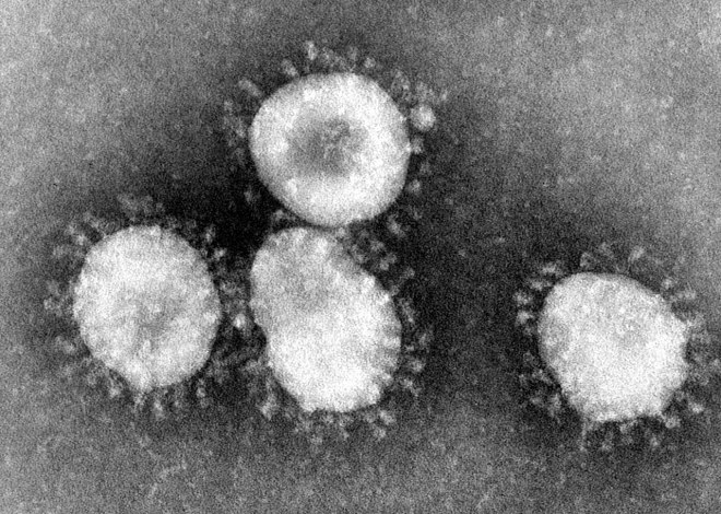 1280px-Coronaviruses_004_lores